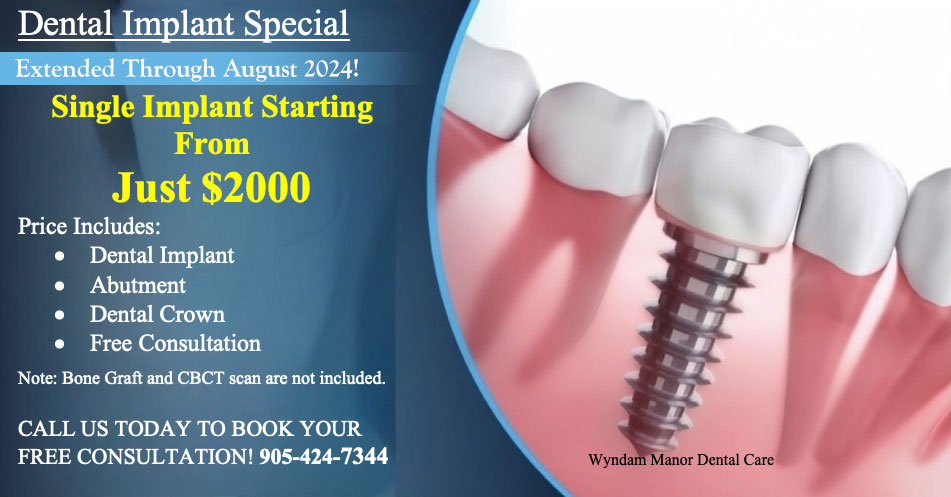 Dental Implant Special